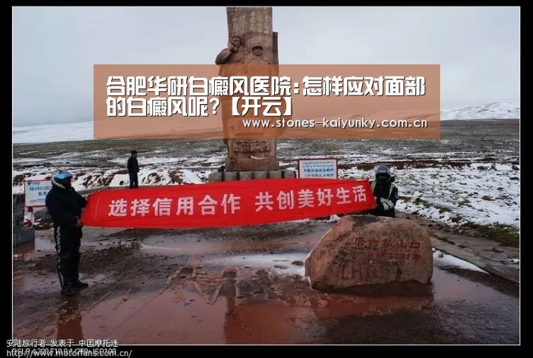合肥华研白癜风医院:怎样应对面部的白癜风呢?【开云】